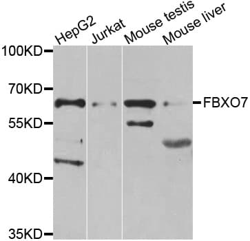 FBXO7 Antibody