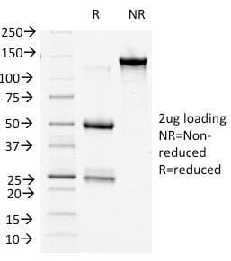 CTNNB1 / Beta Catenin Antibody (clone 9F2, Azide-free, BSA-free)
