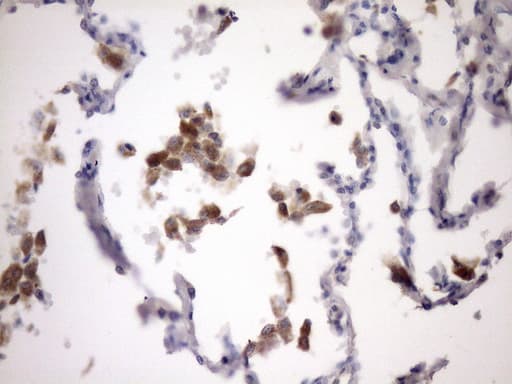 Monoclonal Mouse anti-Human NOTCH1 Antibody (clone OTI2E7, aa2280-2556, IHC)
