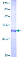 Human FZD3 / Frizzled 3 Protein (Recombinant GST, N-terminus)