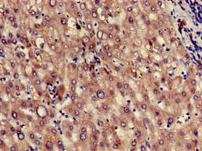 KLKB1 / Plasma Kallikrein Antibody