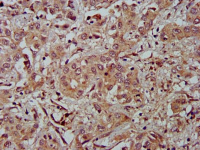 FBLN2 / Fibulin 2 Antibody