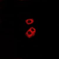 Polyclonal Rabbit anti-Human TPSAB1 / Mast Cell Tryptase Antibody (IF, WB)
