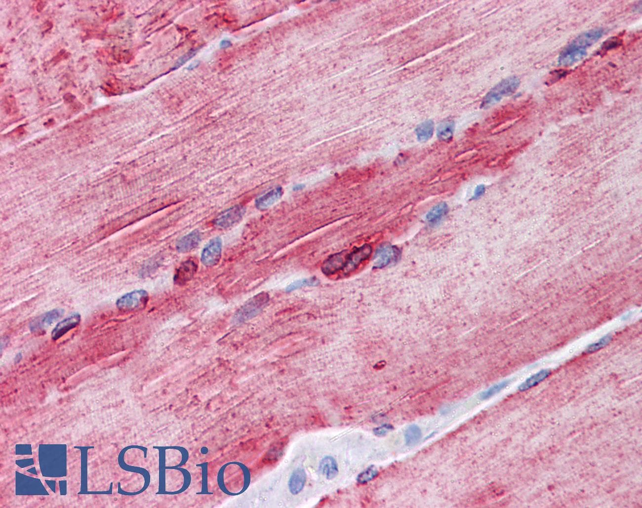IHC-plus™ Monoclonal Mouse anti-Human ATP2A1 / SERCA1 Antibody (clone 1B11, IHC, IF, WB)