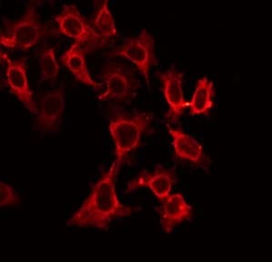 TNFRSF10A / DR4 Antibody