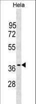 Polyclonal Rabbit anti-Human OCIAD1 Antibody (aa184-210, WB)