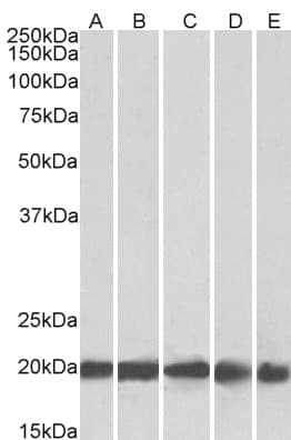 PathPlus™ FTL / Ferritin Light Chain Antibody (aa150-200)