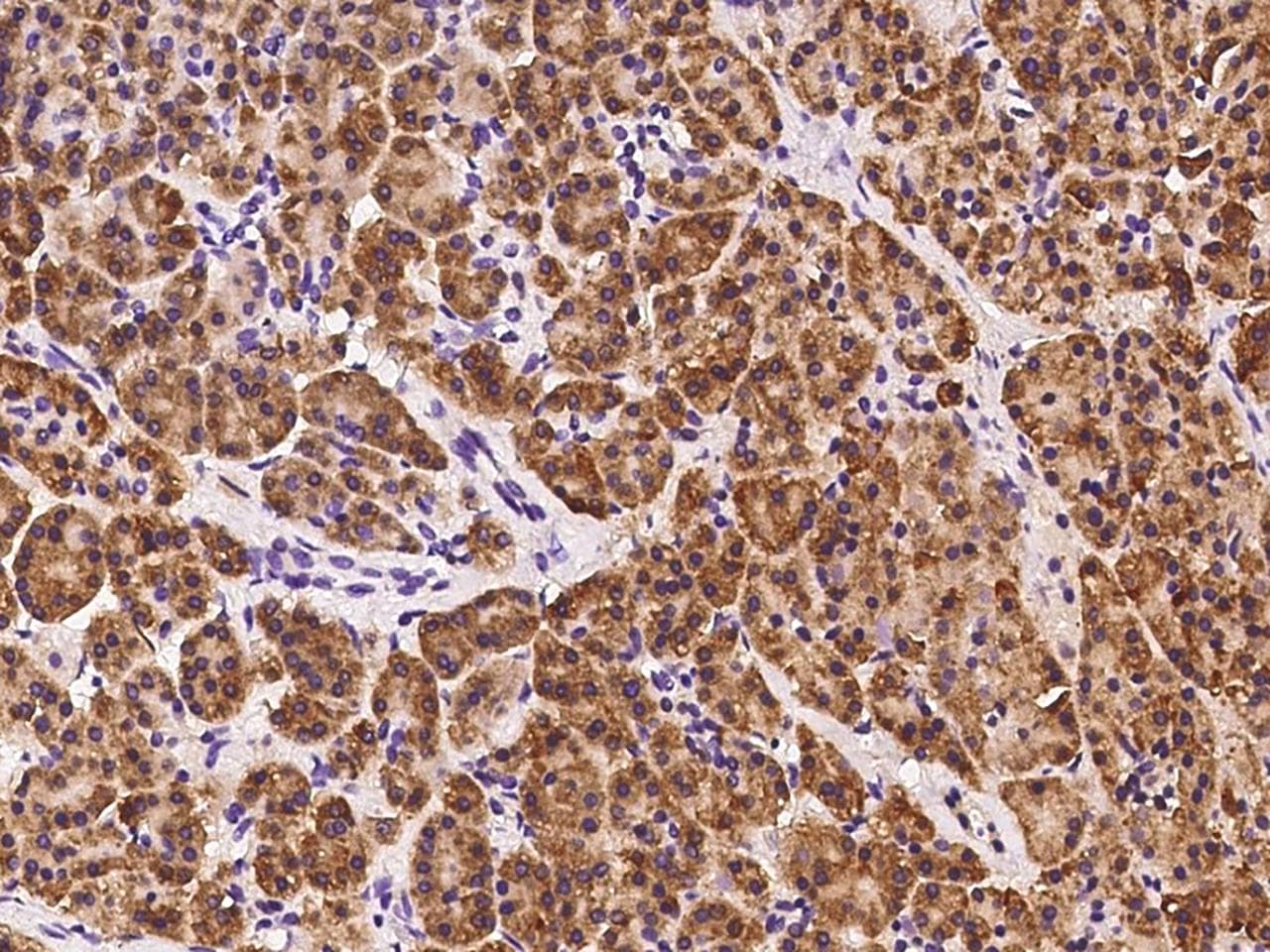 RPS6 / Ribosomal Protein S6 Antibody