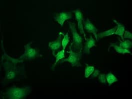 NANP Antibody (clone OTI4D11)