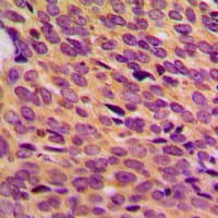 Neurofibromin / NF1 Antibody (Internal)