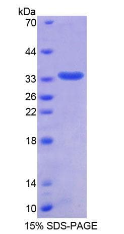 Human TMPO / TP / Thymopoietin Protein (Recombinant His-T7)