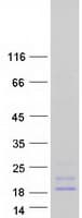 Human SST / Somatostatin Protein (Recombinant Myc-DDK (Flag))