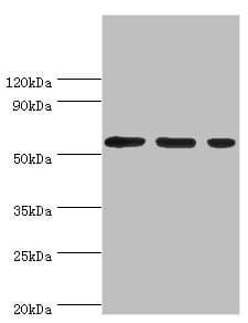 Polyclonal Rabbit anti-Human AAAS / Adracalin Antibody (aa287-546, IHC, WB)