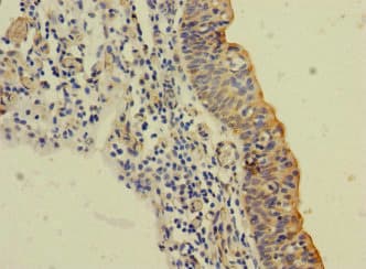 Polyclonal Rabbit anti-Human SLC6A15 / SBAT1 Antibody (IHC, IF)