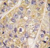 PI4K2B Antibody (aa1-30)