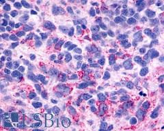PathPlus™ ADGRB3 / BAI3 Antibody (C-Terminus)
