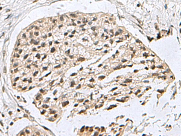 Polyclonal Rabbit anti-Human H2AFJ Antibody (IHC, WB)