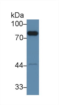 F2 / Prothrombin / Thrombin Antibody (aa325-618, Biotin)