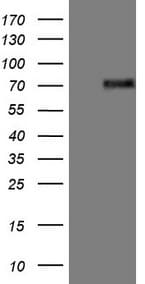ER Alpha / Estrogen Receptor Antibody (aa1-310, clone OTI5E11)