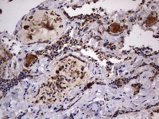 DOCK8 Antibody (aa832-1160, clone OTI4H10)