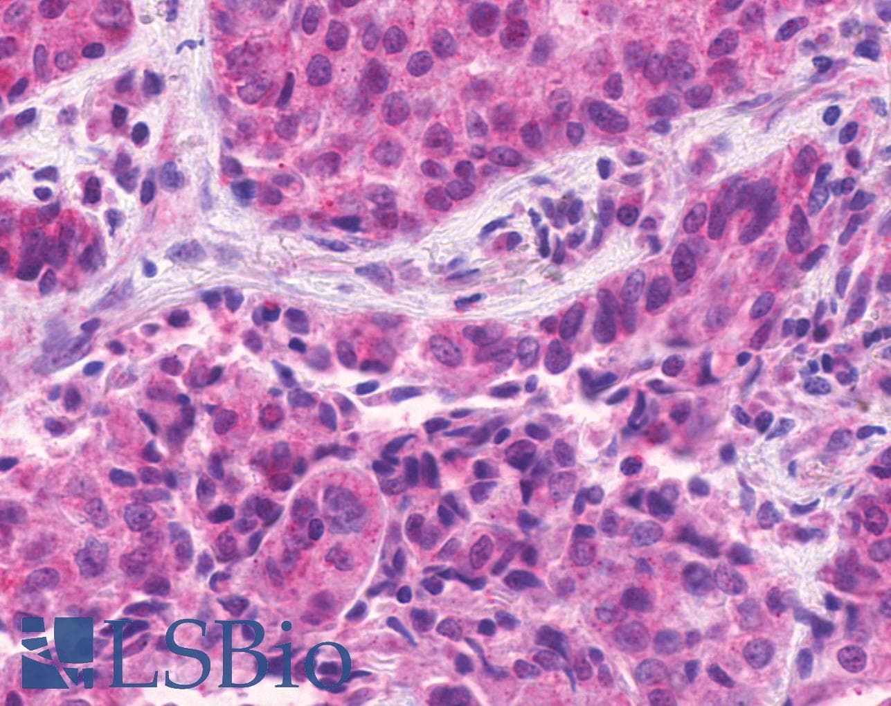 IHC-plus™ ADGRE1 / EMR1 Antibody (N-Terminus)