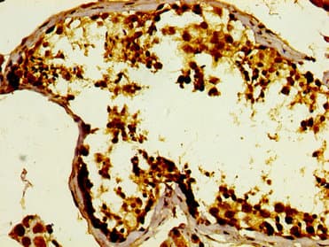 Polyclonal Rabbit anti-Human GPRC6A Antibody (IHC)
