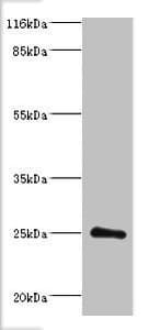 Polyclonal Rabbit anti-Human DGCR6L Antibody (aa1-220, WB)