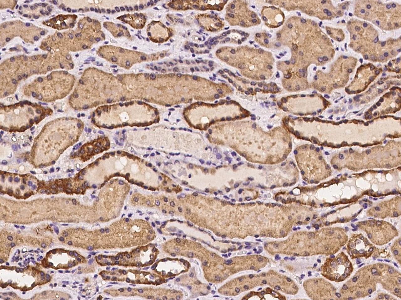KLHL34 Antibody