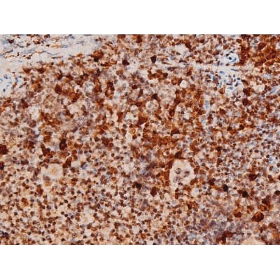 MAPK8 / JNK1 Antibody (phospho-Thr183,pTyr185)
