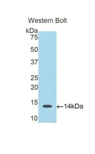 S100B / S100 Beta Antibody (aa1-92)