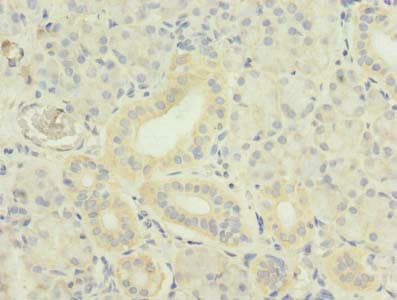 Polyclonal Rabbit anti-Human TNFSF12 / TWEAK Antibody (IHC, WB)