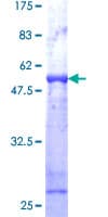 Human VAPB Protein (Recombinant GST)