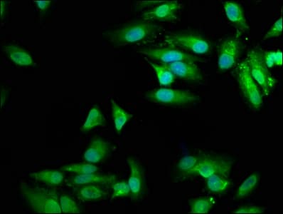 MVD Antibody