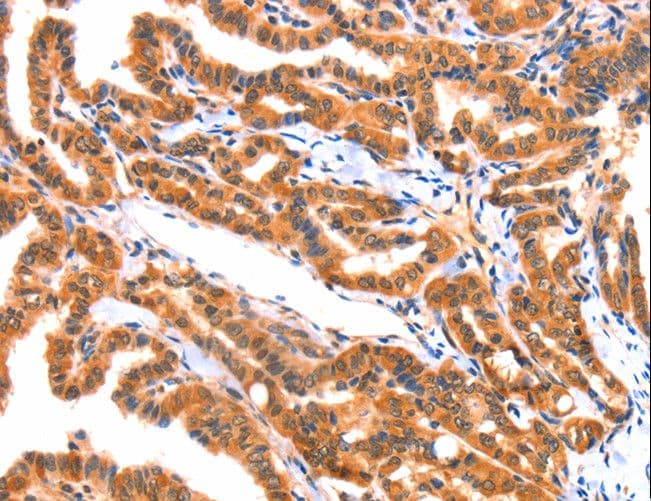 AK5 / Adenylate Kinase 5 Antibody