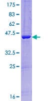 Human IFT27 / RABL4 Protein (Recombinant GST)