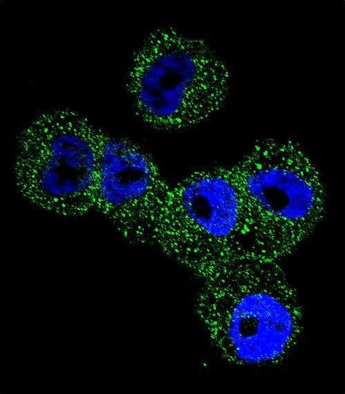 SERPINB5 / Maspin Antibody (aa94-123)