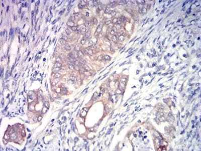 ACSS1 Antibody (clone 3A7C1)