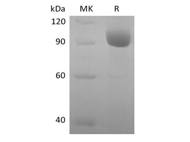 Human LILRA3 / CD85e Protein (Recombinant Fc, C-terminus)