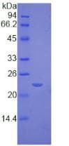 Mouse TIMP2 Protein (Recombinant His)