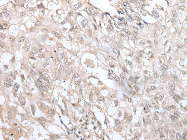 VRK3 Antibody