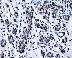 Monoclonal Mouse anti-Human RIP1 / RALBP1 Antibody (clone OTI11B2, IHC, IF, WB)