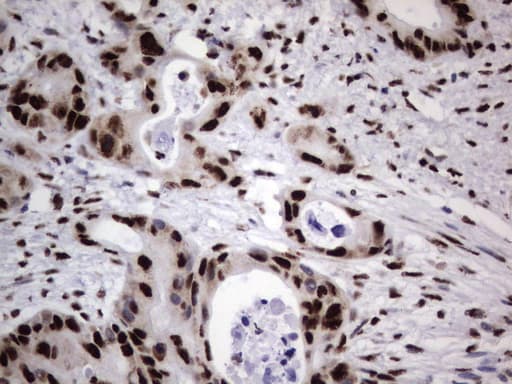 DDX56 Antibody (aa323-547, clone UMAB152)