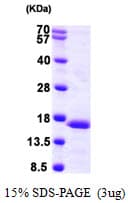 Human PFDN6 / HKE2 Protein (Recombinant His)