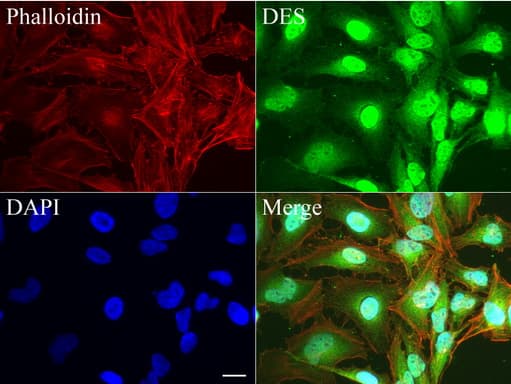 DES / Desmin Antibody (clone UMAB166, Carrier-free)