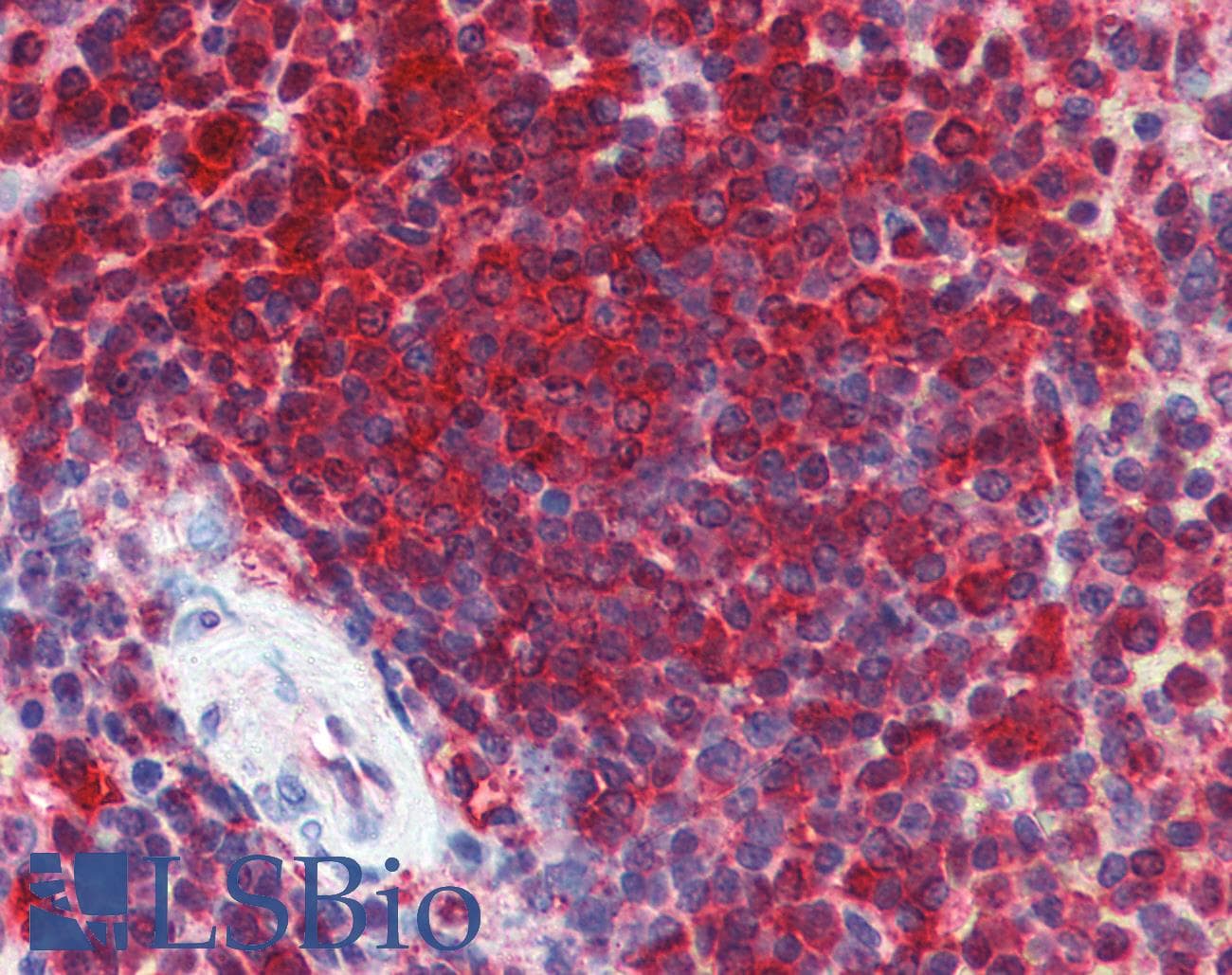 PathPlus™ Polyclonal Rabbit anti-Human ENO1 / Alpha Enolase Antibody (aa246-295, IHC, WB)
