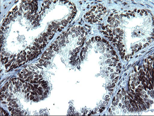 Monoclonal Mouse anti-Human ARNTL / BMAL1 Antibody (clone OTI1H6, IHC, WB)