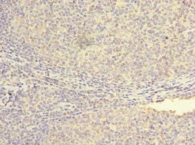 NXNL2 Antibody