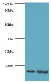 RBX1 / ROC1 Antibody (aa1-108)