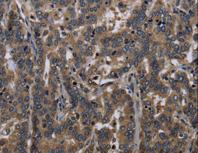 FGF18 Antibody
