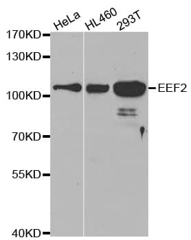 EEF2 / Elongation Factor 2 Antibody
